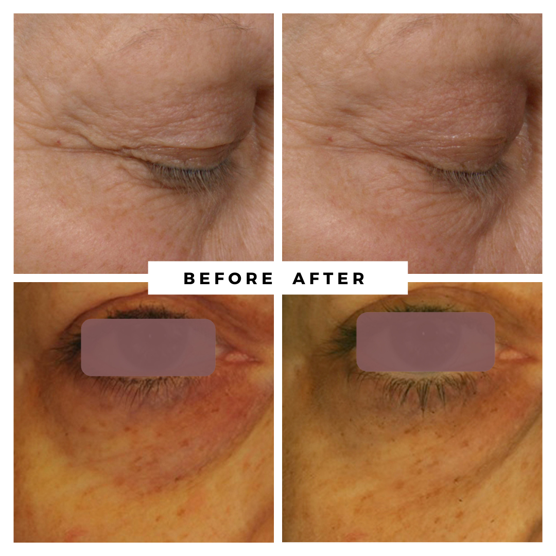 Miracle Eye Cream 3in1, Plump, Lift and Firm 15ml